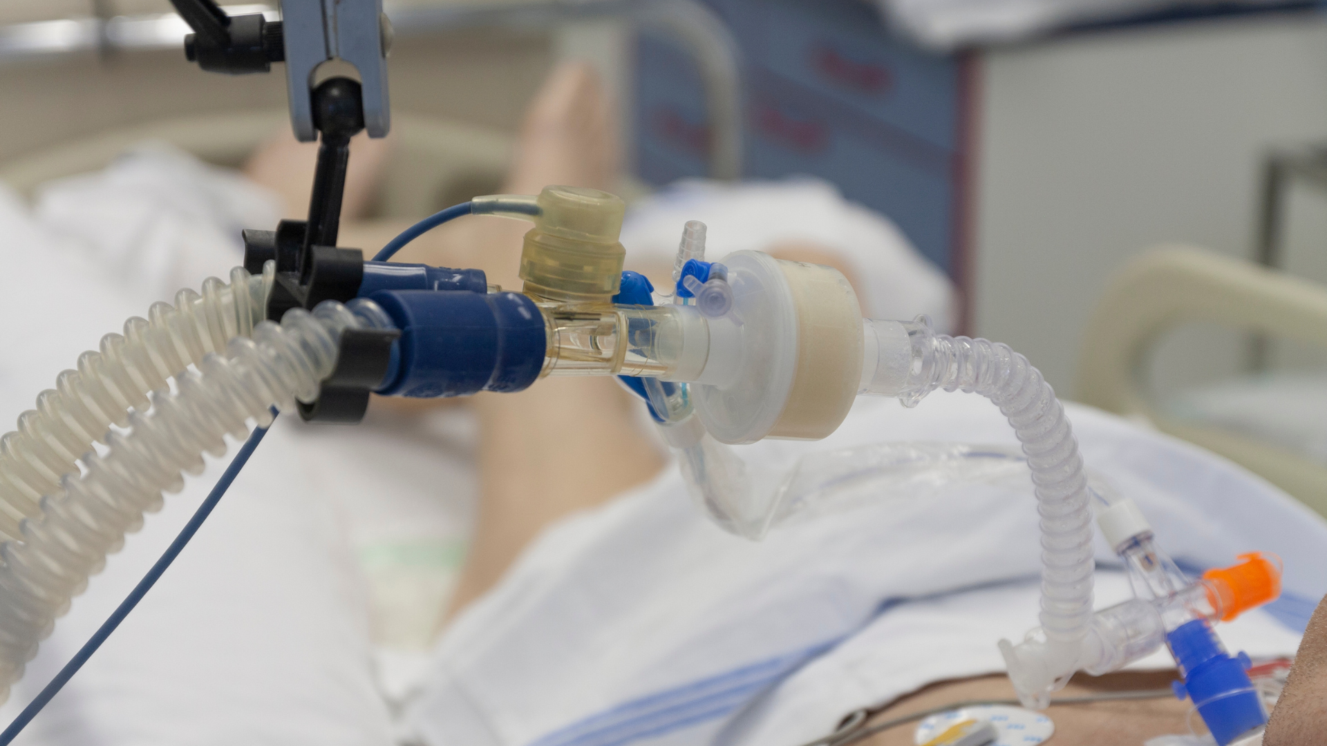 Circuit de ventilation et raccords en gros plan sur un patient hospitalisé.